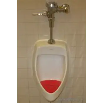 urinal-11-2040396-13776.webp
